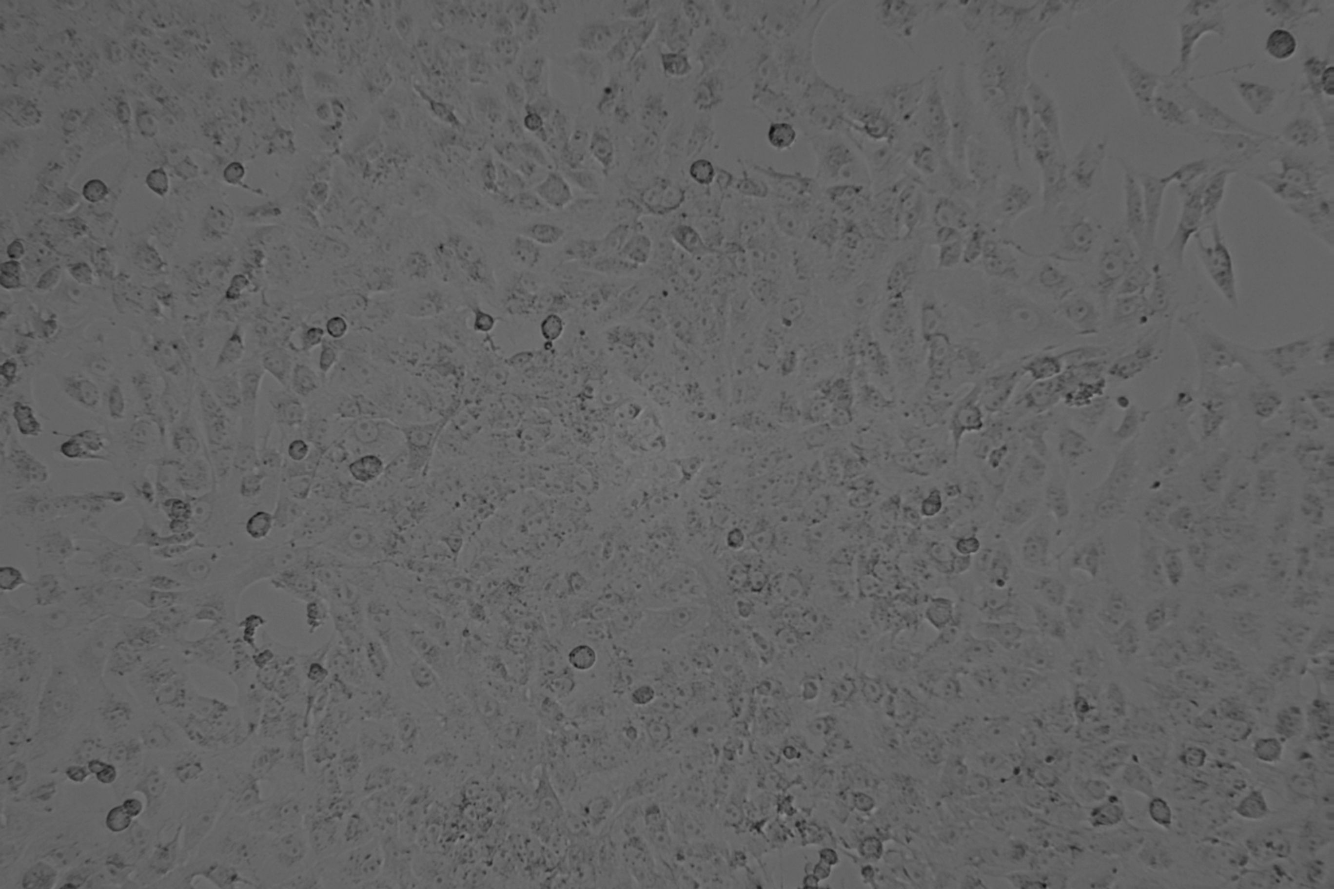 人膀胱癌順鉑耐藥株BIU-87/DDP　